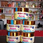 Acne Face Cream